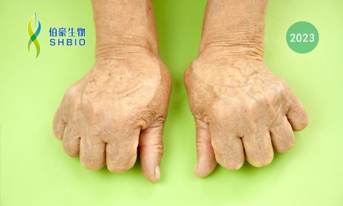 高分文献一作分享会 | 时空组学技术助力发现类风湿关节炎疾病治疗新靶点