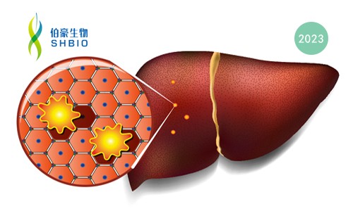 高分文献一作分享会 | 肝细胞癌早期检测生物标志物研究分享