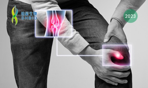 mRNA-seq 项目文章 | 靶向 KAT2A 通过表观遗传和代谢重编程抑制炎性巨噬细胞活化和类风湿关节炎