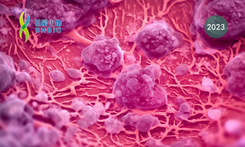 文献解读 | MFN2 介导的线粒体 - 内质网接触通过维持线粒体钙稳态增强 CD8+ T 细胞在肿瘤微环境中的代谢适应和效应功能